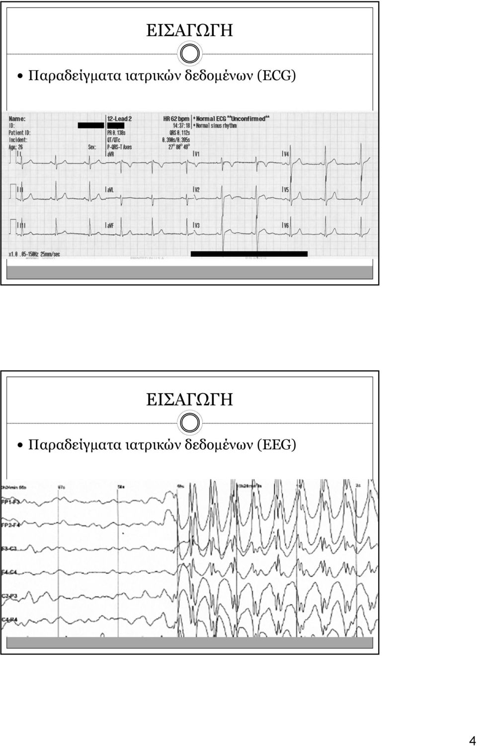 (ECG)   (EEG) 4