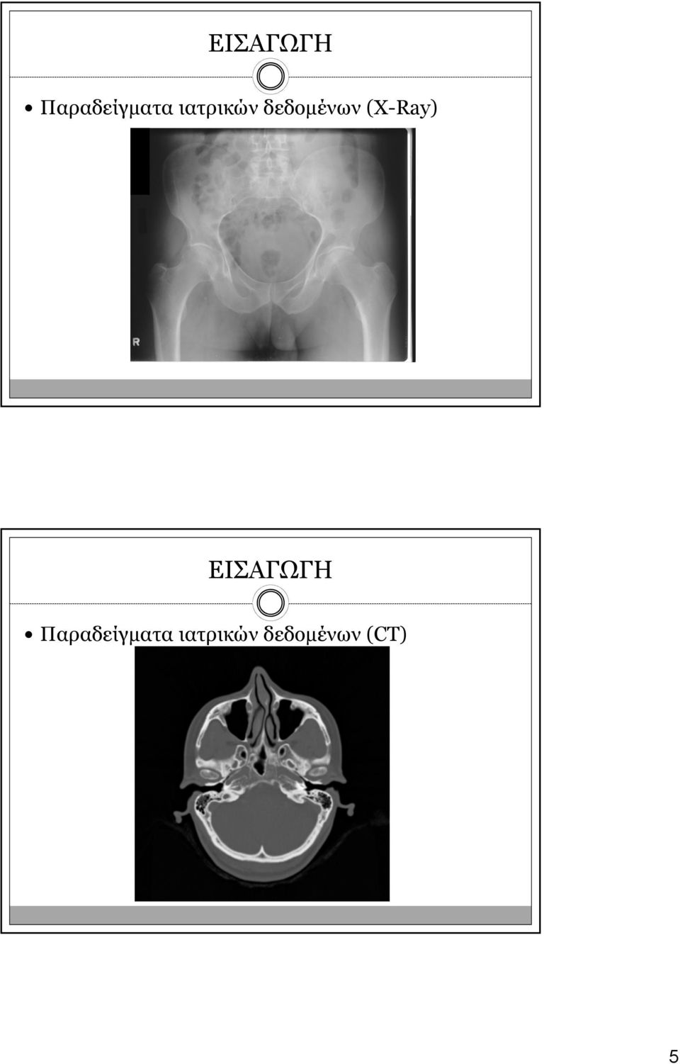 (X-Ray)   (CT) 5