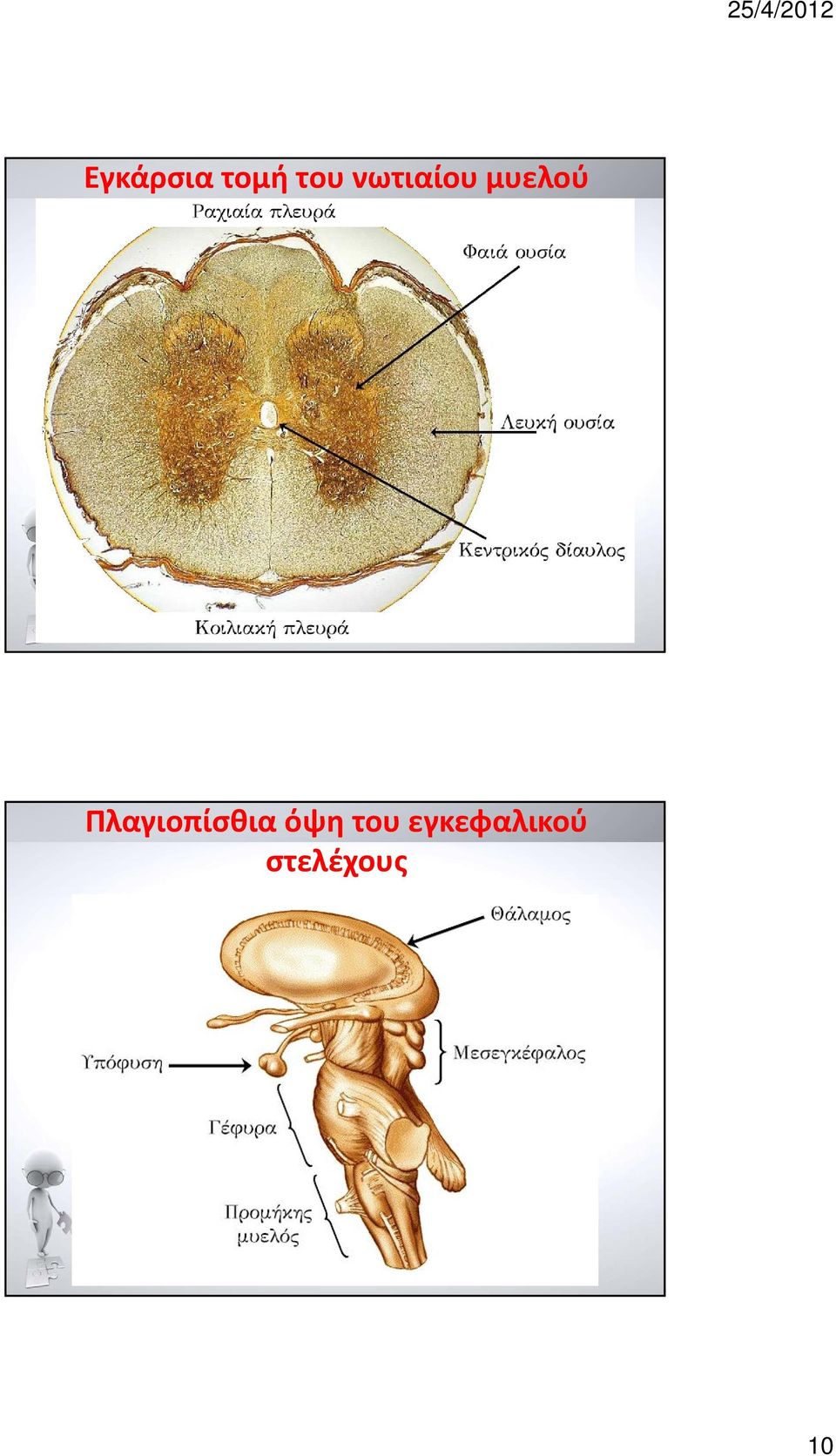 Πλαγιοπίσθια όψη