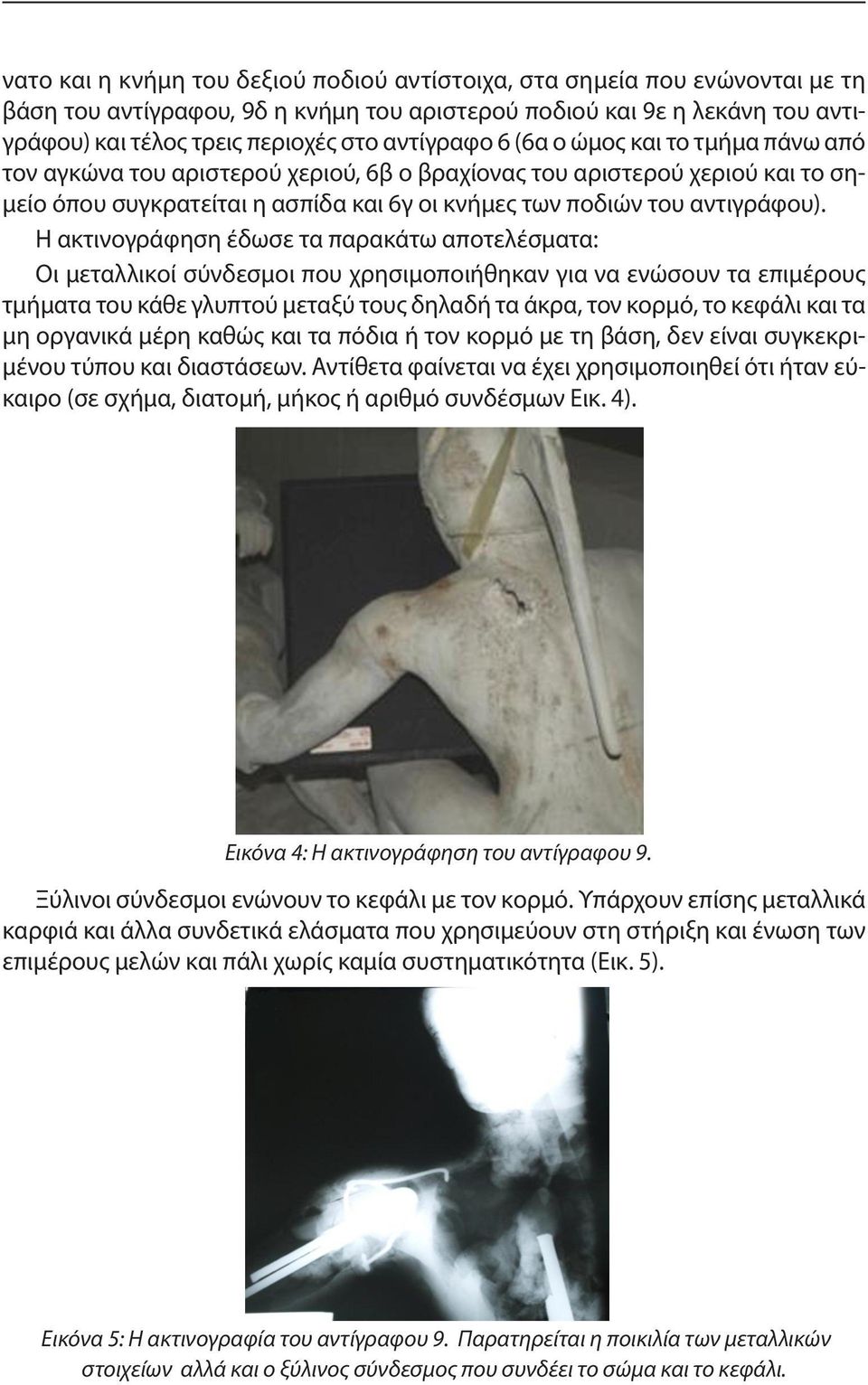 Η ακτινογράφηση έδωσε τα παρακάτω αποτελέσματα: Οι μεταλλικοί σύνδεσμοι που χρησιμοποιήθηκαν για να ενώσουν τα επιμέρους τμήματα του κάθε γλυπτού μεταξύ τους δηλαδή τα άκρα, τον κορμό, το κεφάλι και