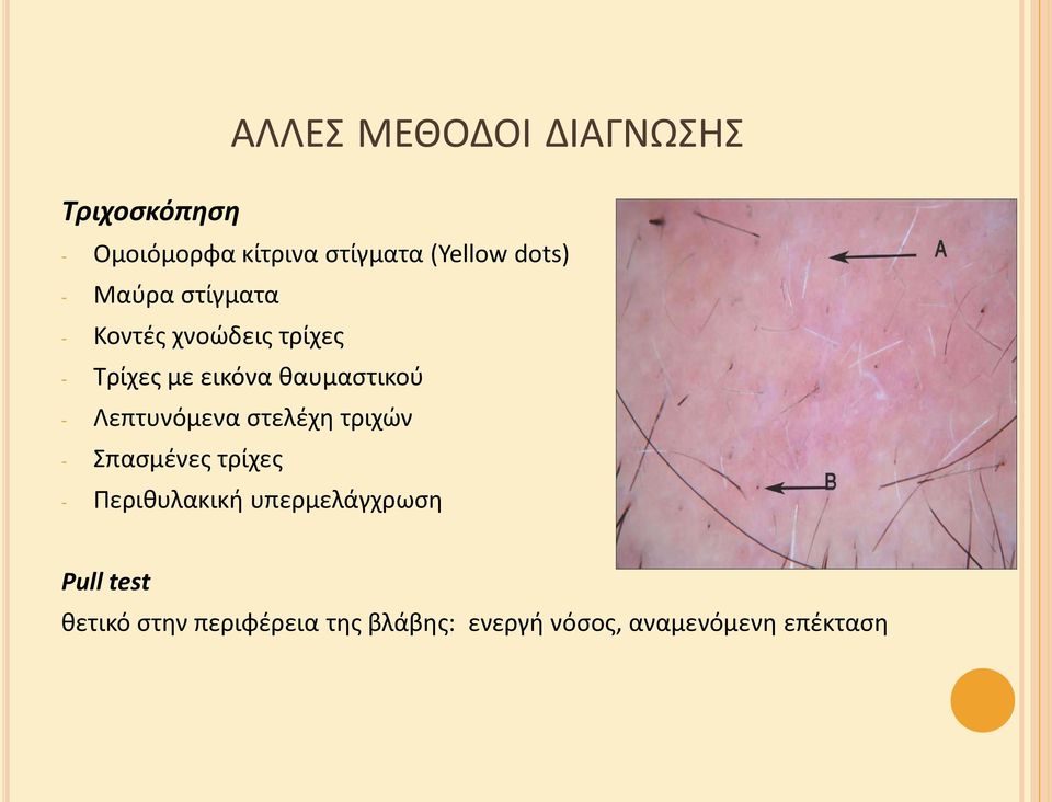 καυμαςτικοφ - Λεπτυνόμενα ςτελζχθ τριχϊν - παςμζνεσ τρίχεσ - Περικυλακικι