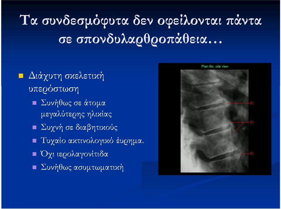 Συνήθως σε άτομα μεγαλύτερης ηλικίας Συχνή σε