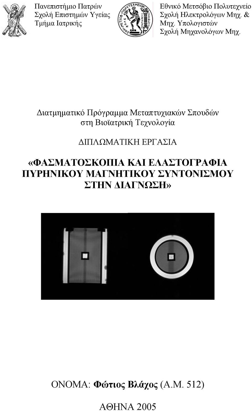 Διατμηματικό Πρόραμμα Μετατυχιακών Σουδών τη Βιοϊατρική Τεχνολοία ΔΙΠΛΜΑΤΙΚΗ ΕΡΓΑΣΙΑ