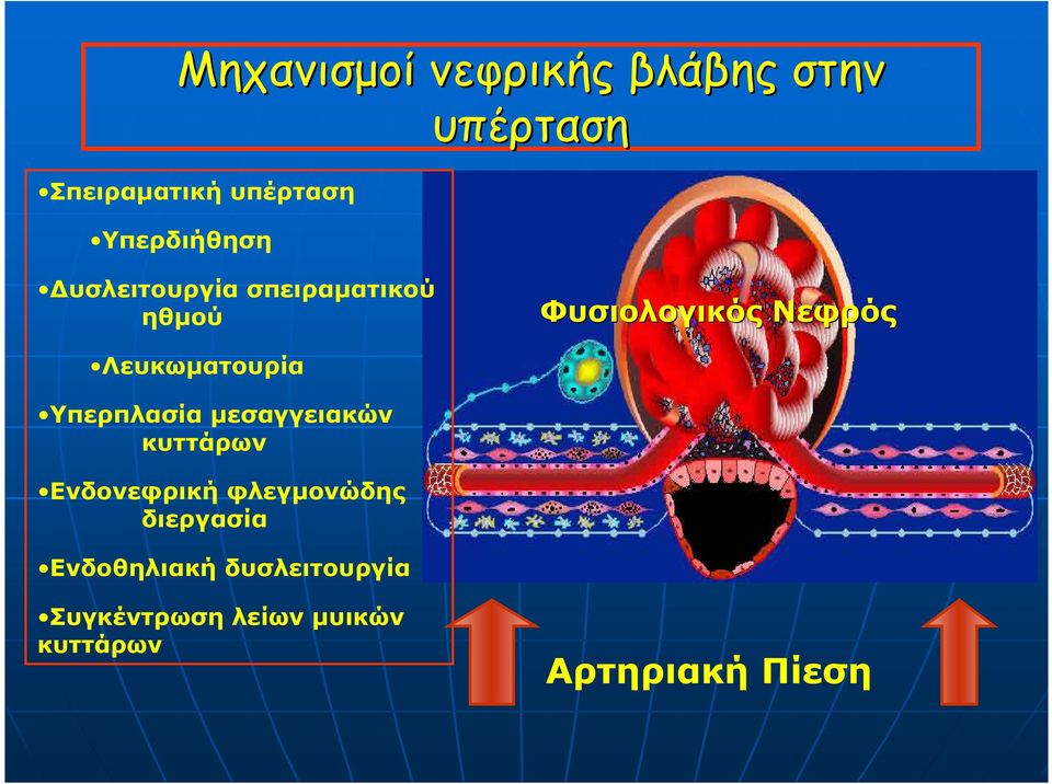 Λευκωµατουρία Υπερπλασία µεσαγγειακών κυττάρων Ενδονεφρική φλεγµονώδης