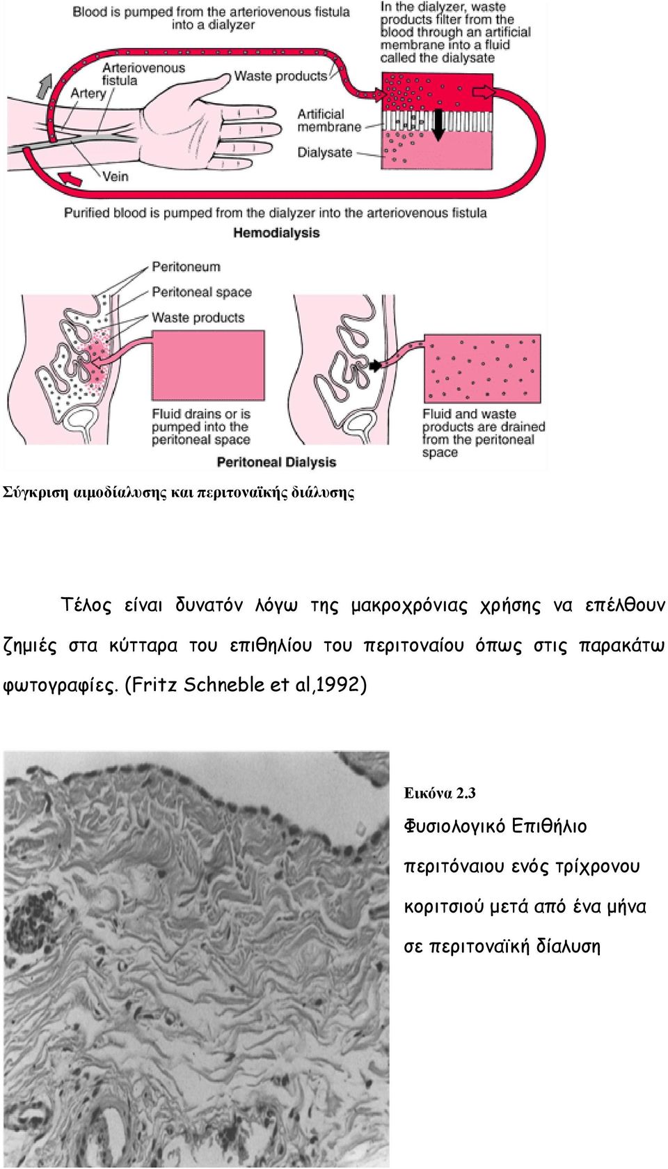 όπως στις παρακάτω φωτογραφίες. (Fritz Schneble et al,1992) Εικόνα 2.