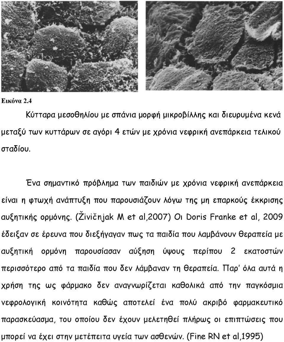 (Živičnjak M et al,2007) Οι Doris Franke et al, 2009 έδειξαν σε έρευνα που διεξήγαγαν πως τα παιδία που λαµβάνουν θεραπεία µε αυξητική ορµόνη παρουσίασαν αύξηση ύψους περίπου 2 εκατοστών περισσότερο