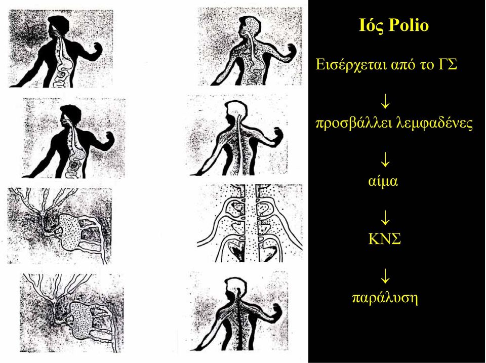 ΓΣ προσβάλλει