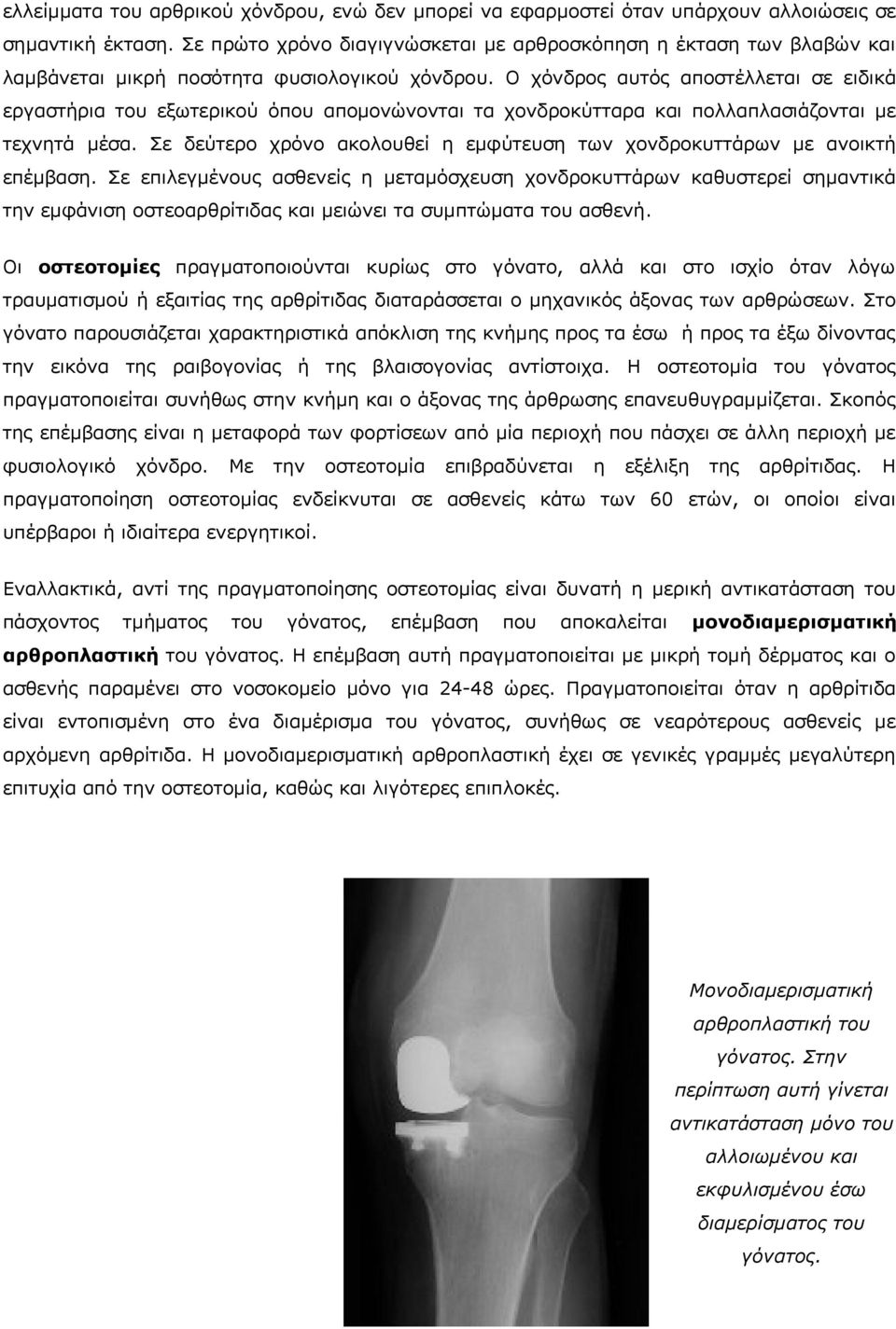 Ο χόνδρος αυτός αποστέλλεται σε ειδικά εργαστήρια του εξωτερικού όπου απομονώνονται τα χονδροκύτταρα και πολλαπλασιάζονται με τεχνητά μέσα.