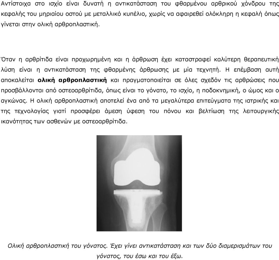 Η επέμβαση αυτή αποκαλείται ολική αρθροπλαστική και πραγματοποιείται σε όλες σχεδόν τις αρθρώσεις που προσβάλλονται από οστεοαρθρίτιδα, όπως είναι το γόνατο, το ισχίο, η ποδοκνημική, ο ώμος και ο