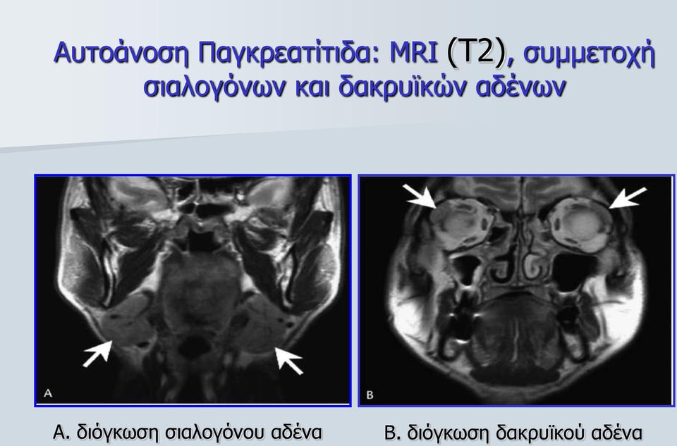 δαθξπτθώλ αδέλσλ Α.