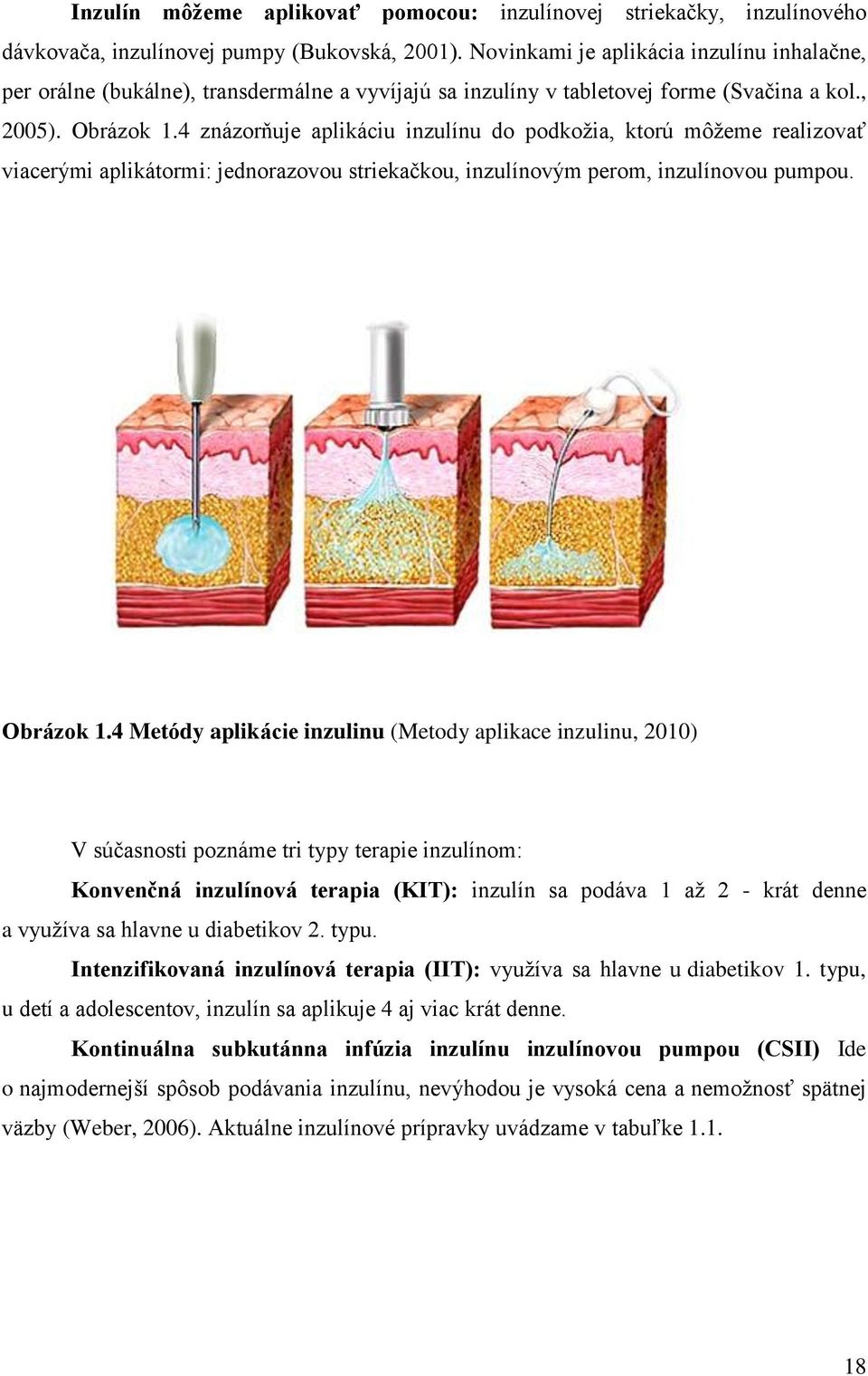 4 znázorňuje aplikáciu inzulínu do podkožia, ktorú môžeme realizovať viacerými aplikátormi: jednorazovou striekačkou, inzulínovým perom, inzulínovou pumpou. Obrázok 1.