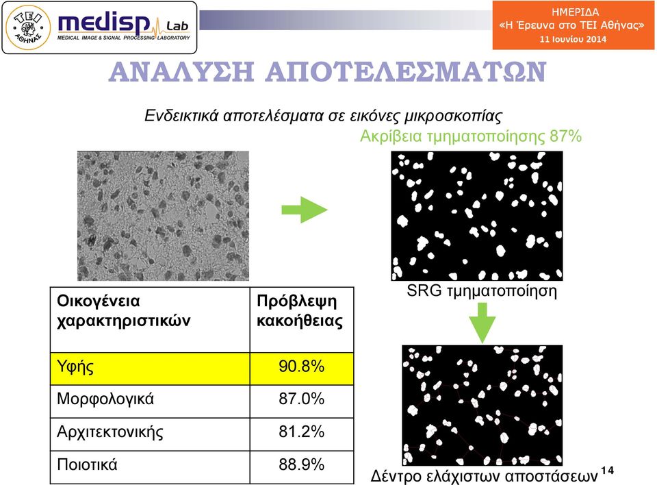 χαρακτηριστικών Πρόβλεψη κακοήθειας SRG τμηματοποίηση Υφής 90.