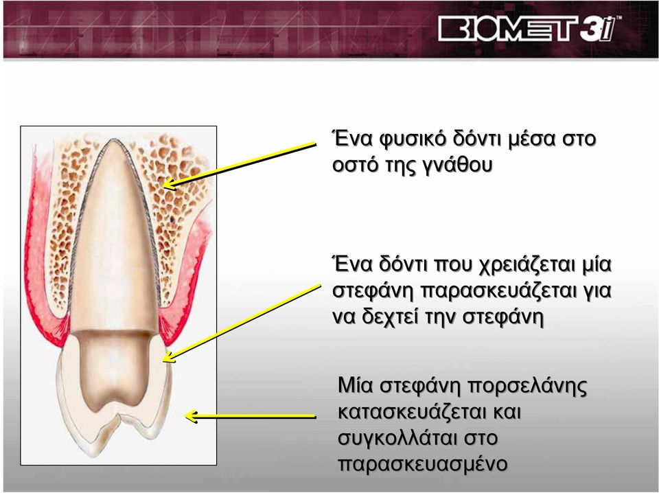 για να δεχτεί την στεφάνη Μία στεφάνη