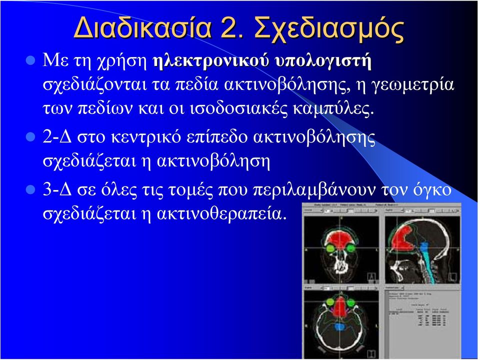 ακτινοβόλησης, η γεωμετρία των πεδίων και οι ισοδοσιακές καμπύλες.