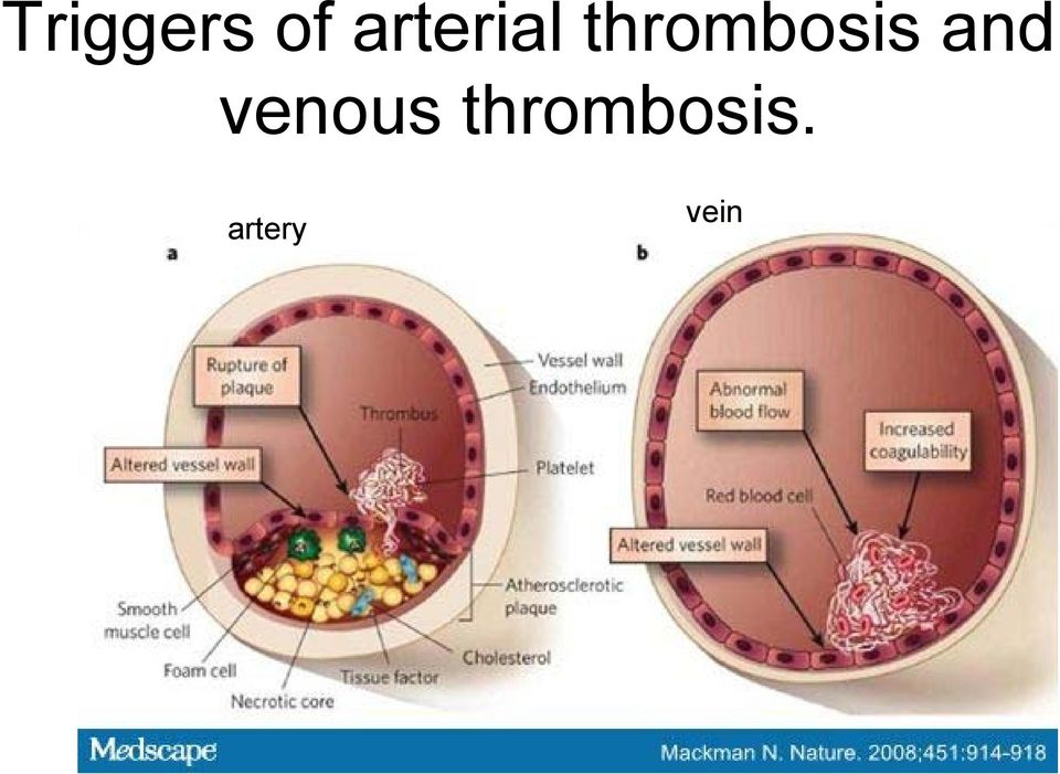 thrombosis and