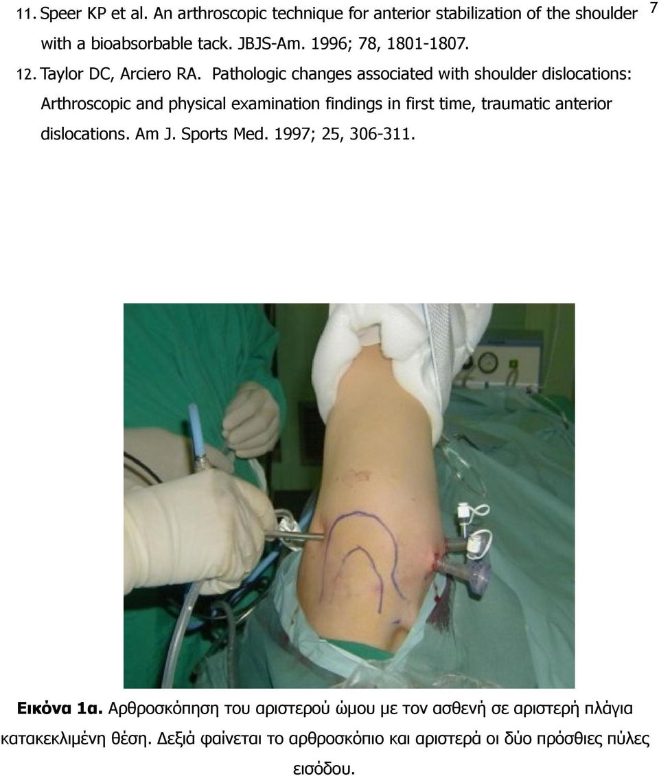 Pathologic changes associated with shoulder dislocations: Arthroscopic and physical examination findings in first time, traumatic