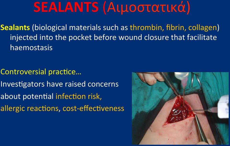injectedintothepocketbeforewoundclosurethatfacilitate haemostasis