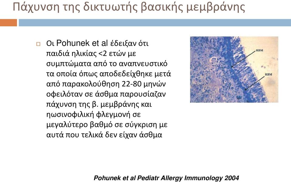 οφειλόταν σε άσθμα παρουσίαζαν πάχυνση της β.