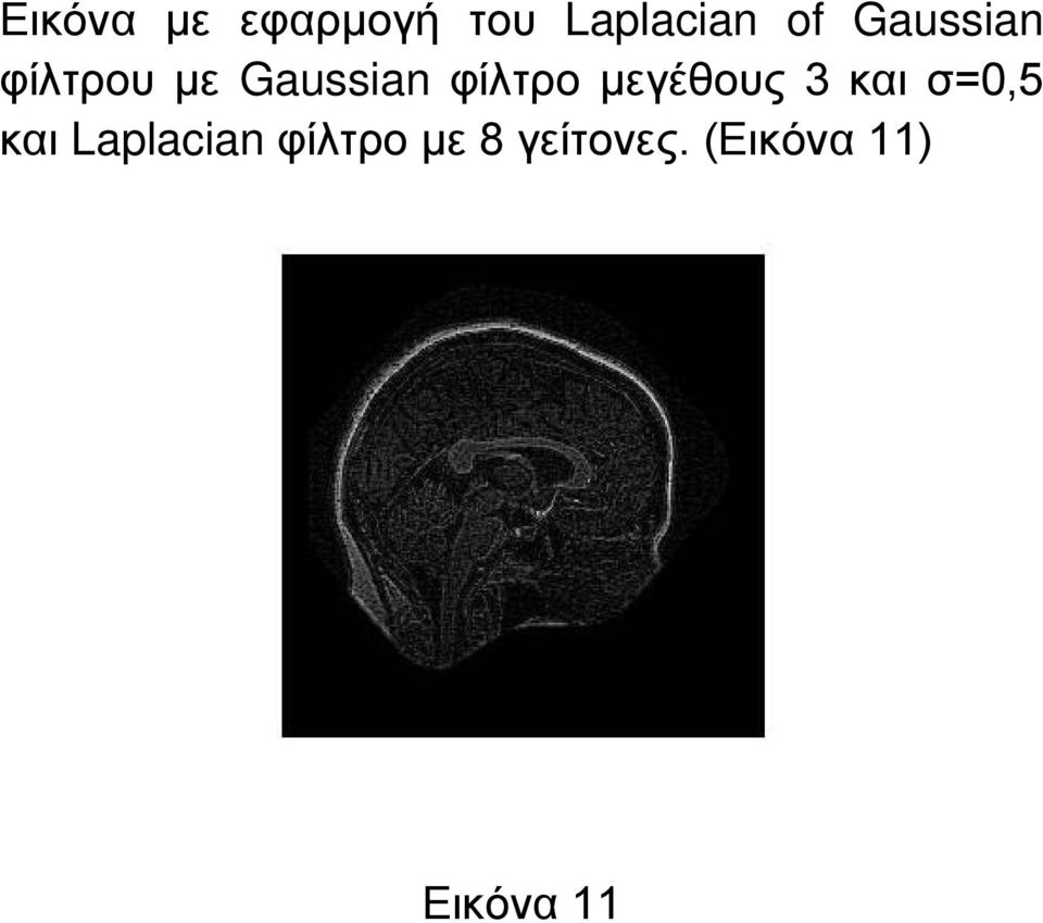 μεγέθους 3 και σ=0,5 και Laplacian