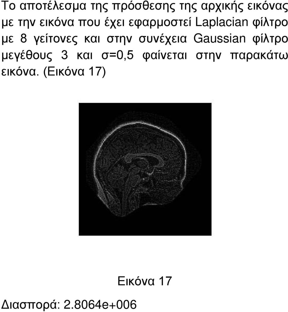 και στην συνέχεια Gaussian φίλτρο μεγέθους 3 και σ=0,5