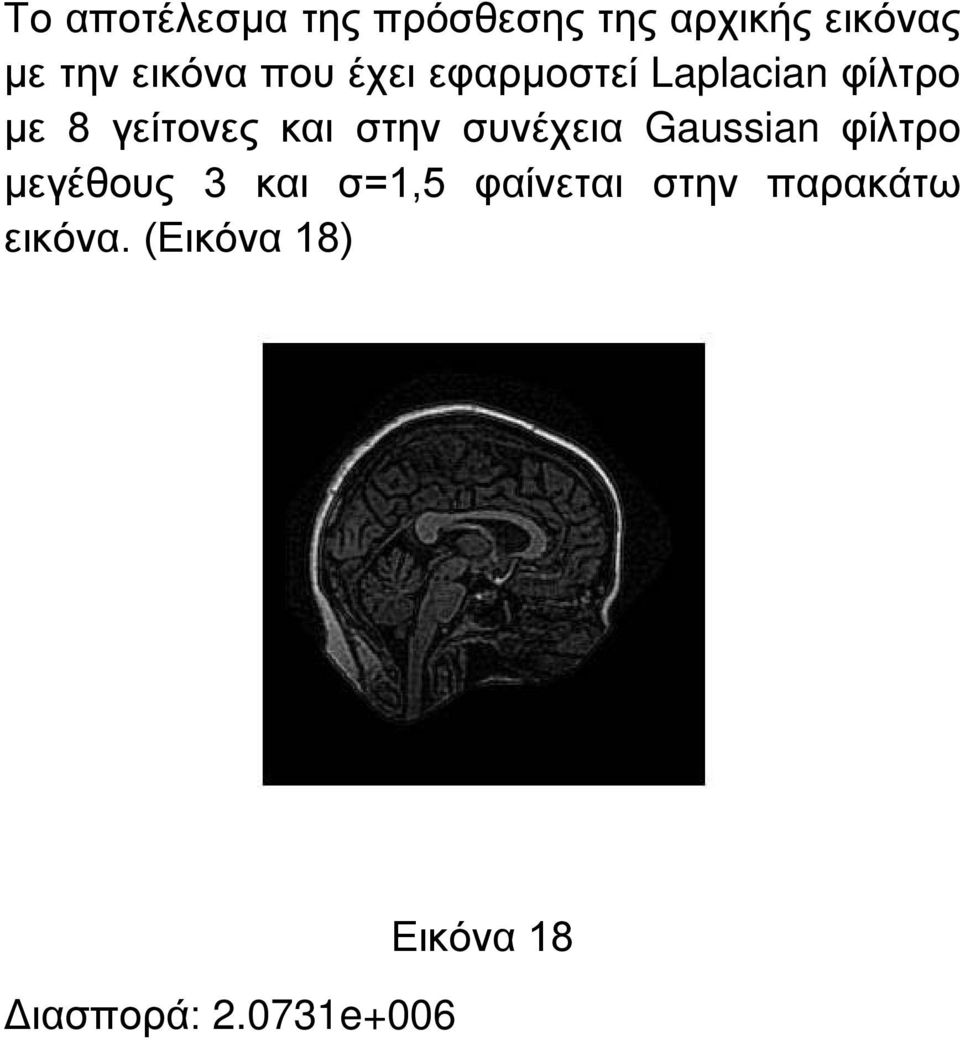 και στην συνέχεια Gaussian φίλτρο μεγέθους 3 και σ=1,5