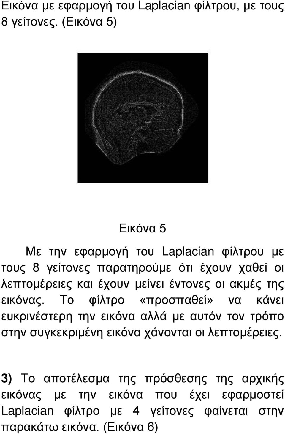 έχουν μείνει έντονες οι ακμές της εικόνας.