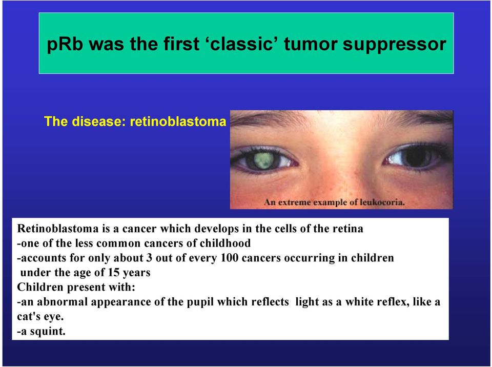 about 3 out of every 100 cancers occurring in children under the age of 15 years Children present with: