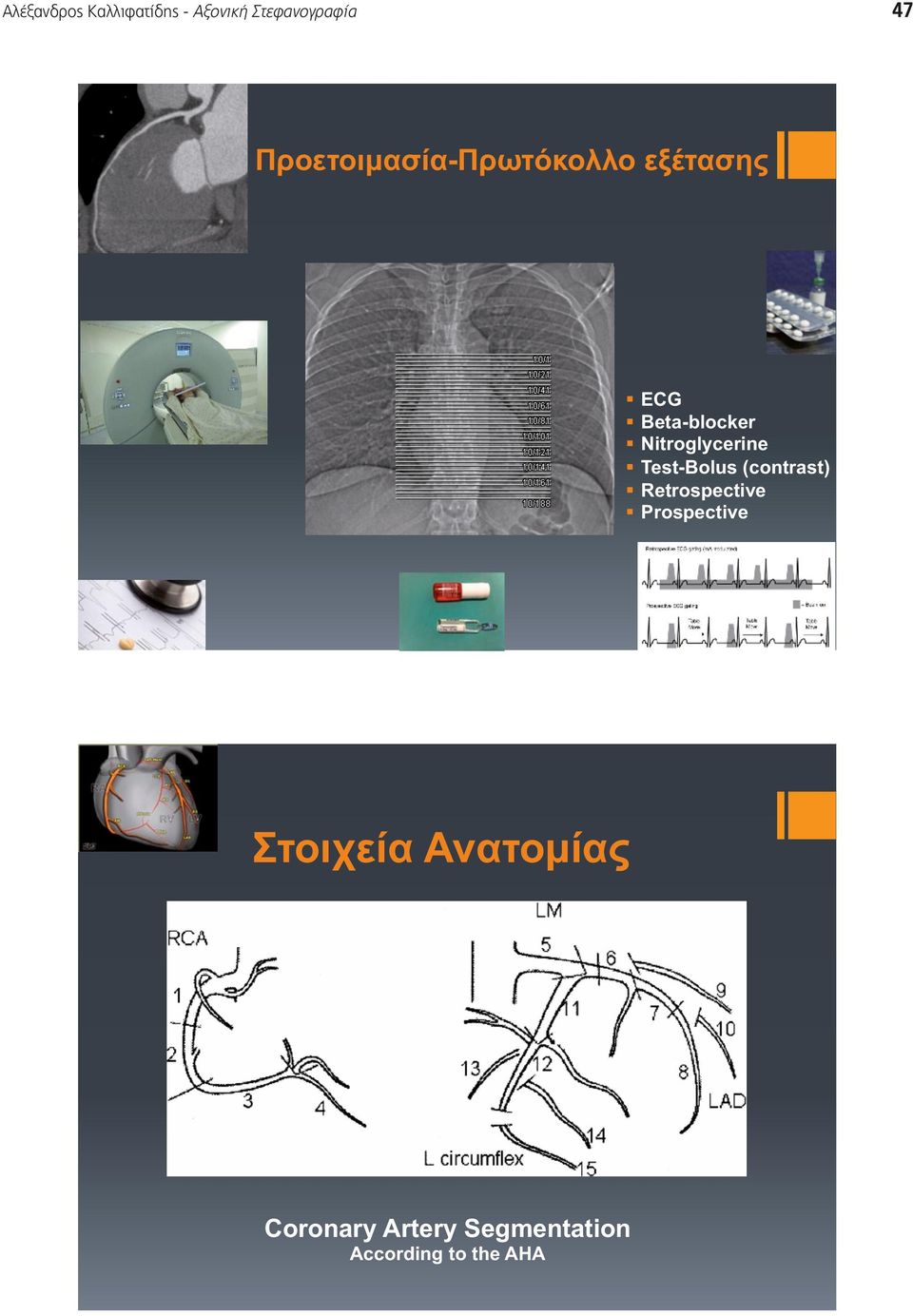 Nitroglycerine Test-Bolus (contrast) Retrospective