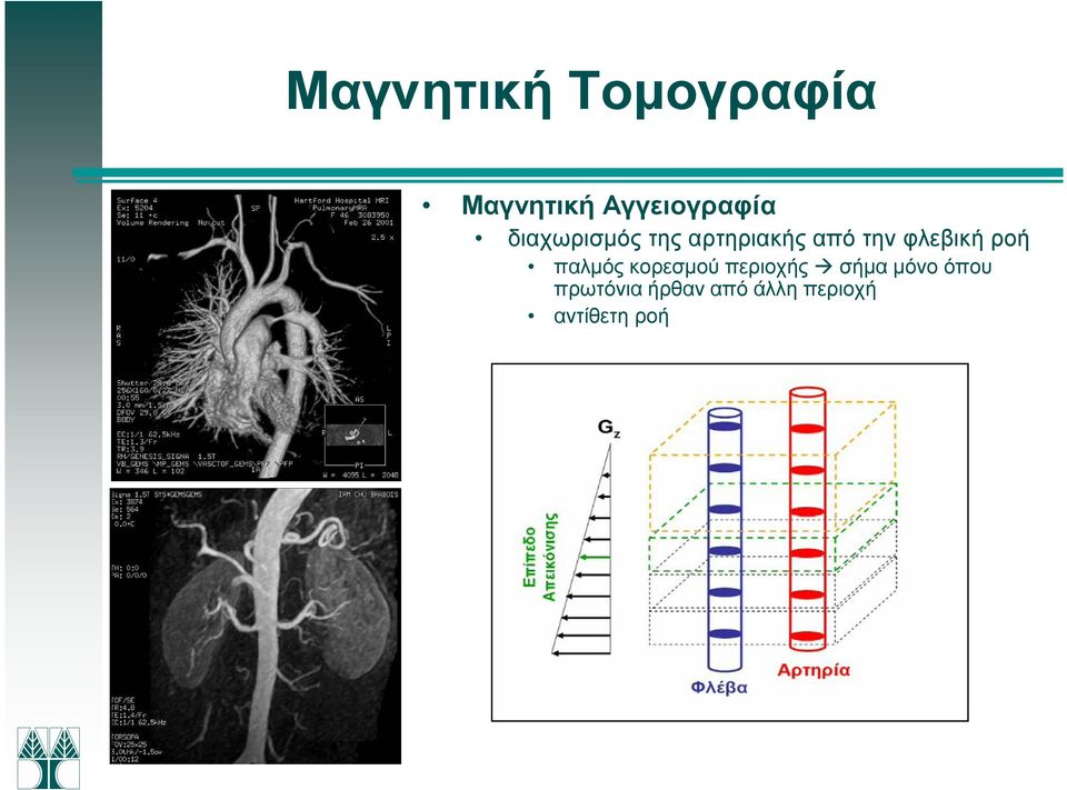 κορεσµού περιοχής σήµα µόνο όπου