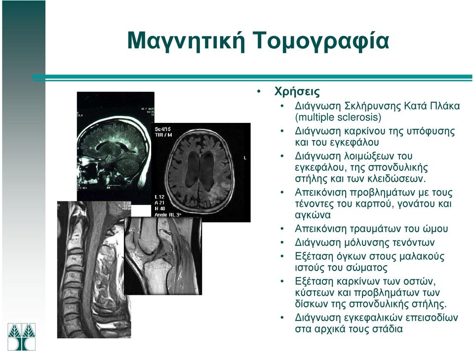 Απεικόνιση προβληµάτων µε τους τένοντες του καρπού, γονάτου και αγκώνα Απεικόνιση τραυµάτων του ώµου ιάγνωση µόλυνσης