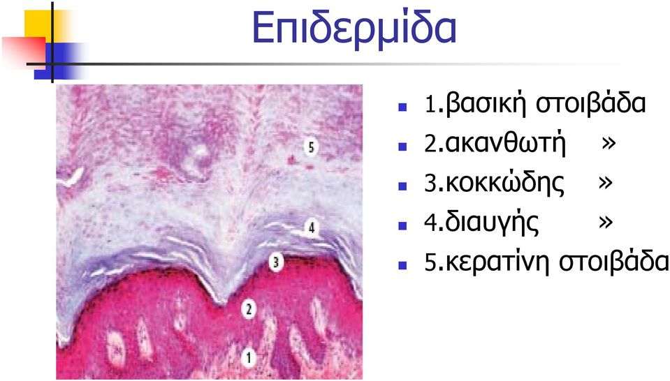 ακανθωτή» 3.