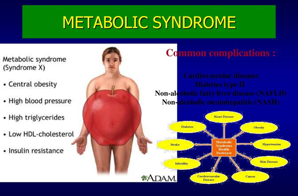 II Non-alcoholic fatty liver disease