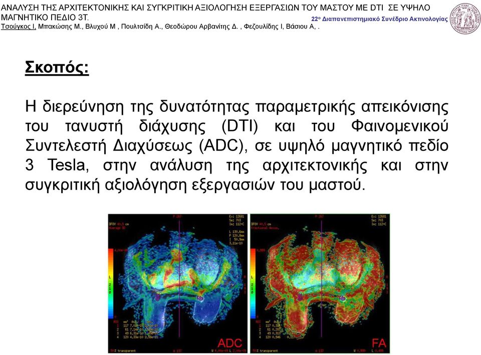 Διαχύσεως (ADC), σε υψηλό μαγνητικό πεδίο 3 Tesla, στην ανάλυση