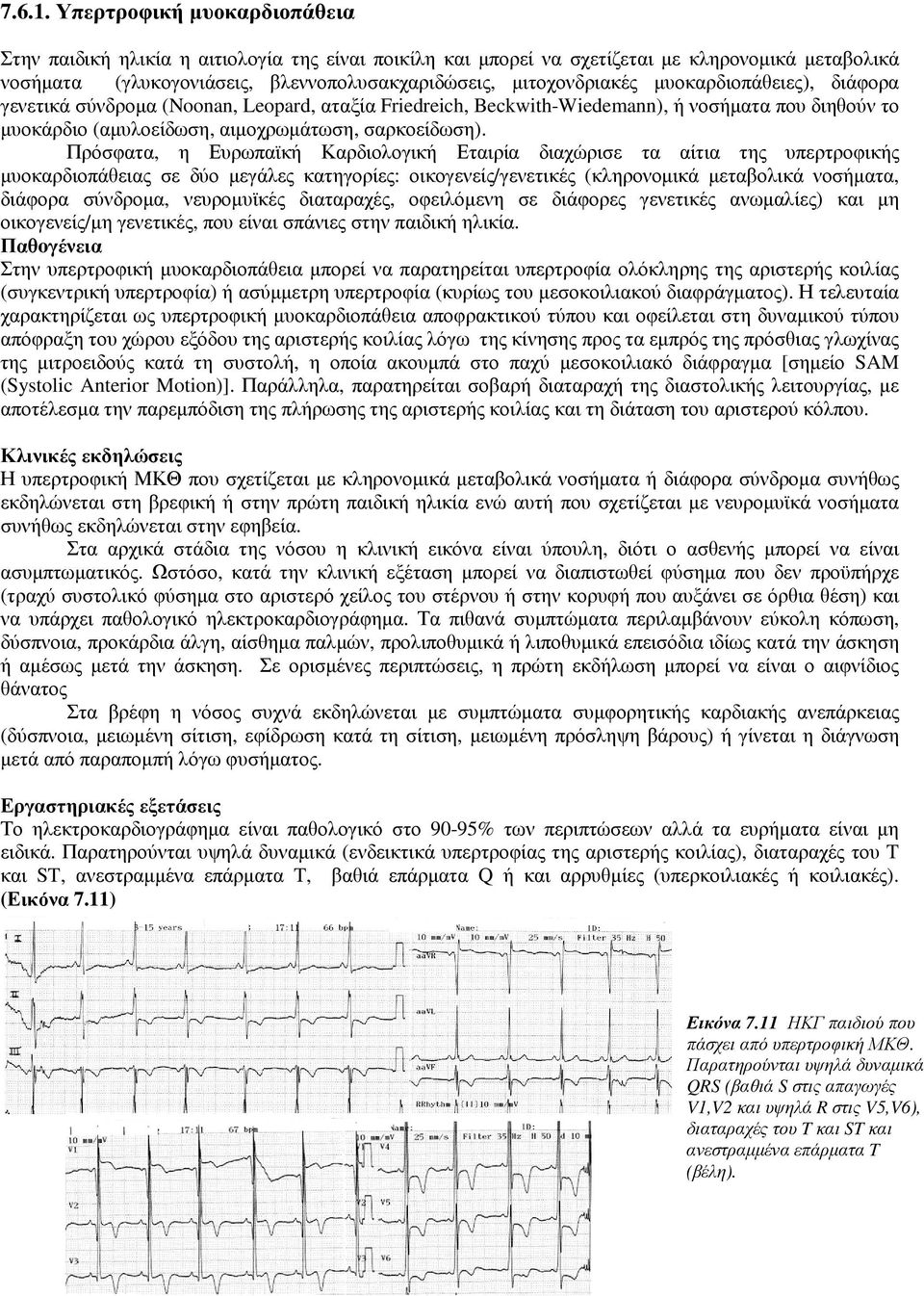 µυοκαρδιοπάθειες), διάφορα γενετικά σύνδροµα (Noonan, Leopard, αταξία Friedreich, Beckwith-Wiedemann), ή νοσήµατα που διηθούν το µυοκάρδιο (αµυλοείδωση, αιµοχρωµάτωση, σαρκοείδωση).