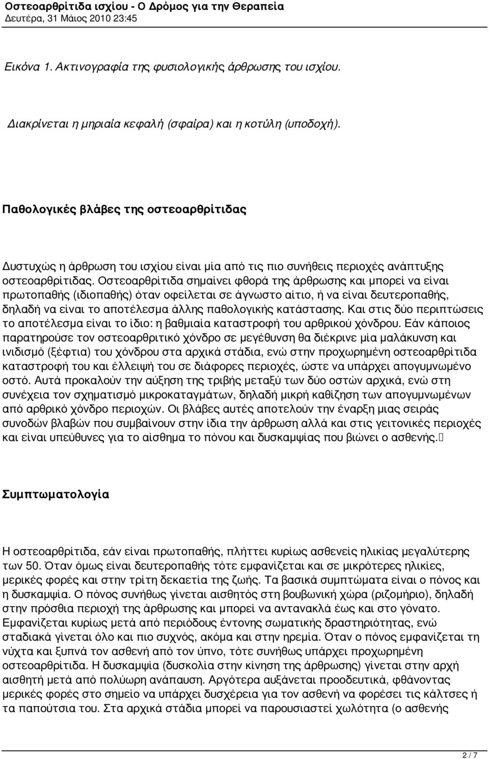 Οστεοαρθρίτιδα σημαίνει φθορά της άρθρωσης και μπορεί να είναι πρωτοπαθής (ιδιοπαθής) όταν οφείλεται σε άγνωστο αίτιο, ή να είναι δευτεροπαθής, δηλαδή να είναι το αποτέλεσμα άλλης παθολογικής