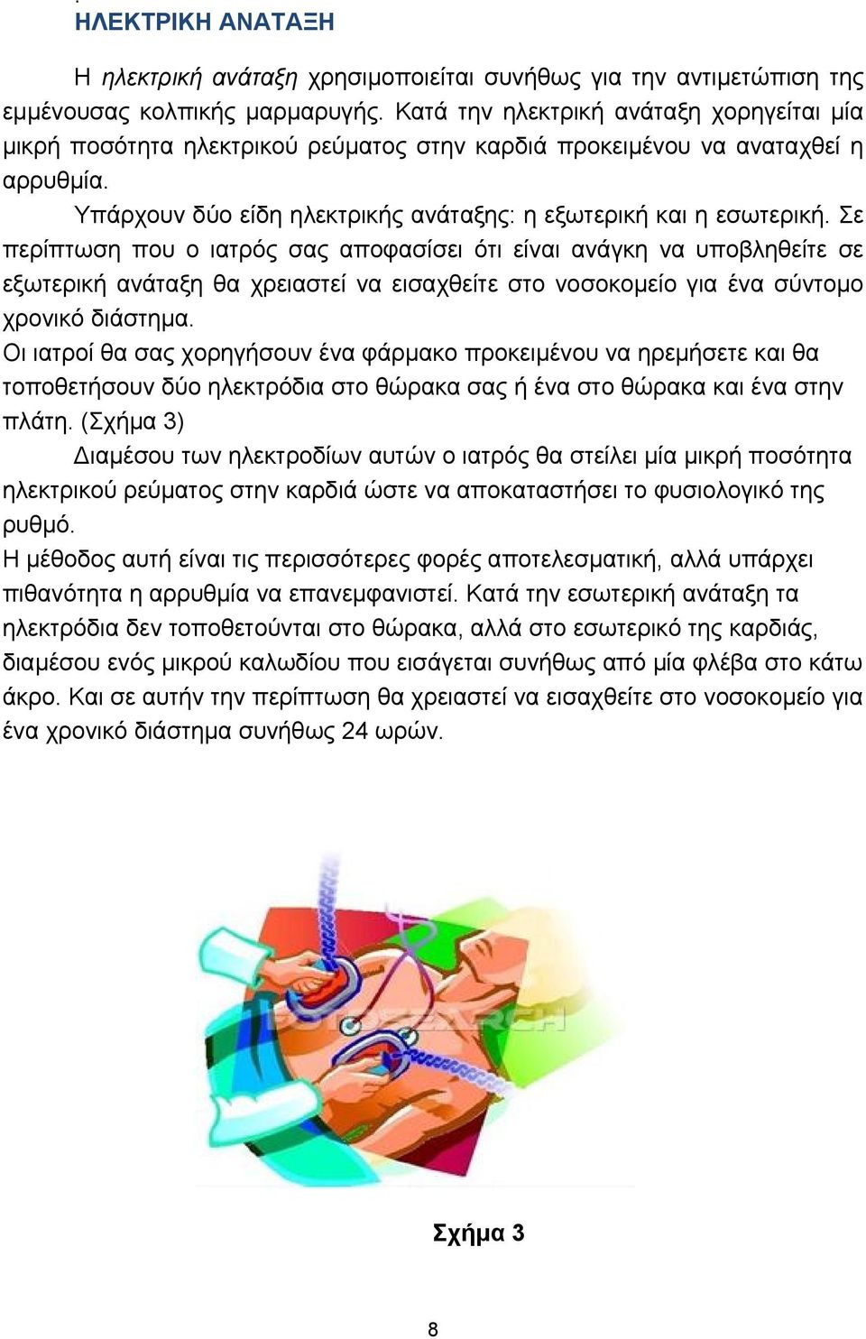 Σε περίπτωση που ο ιατρός σας αποφασίσει ότι είναι ανάγκη να υποβληθείτε σε εξωτερική ανάταξη θα χρειαστεί να εισαχθείτε στο νοσοκομείο για ένα σύντομο χρονικό διάστημα.