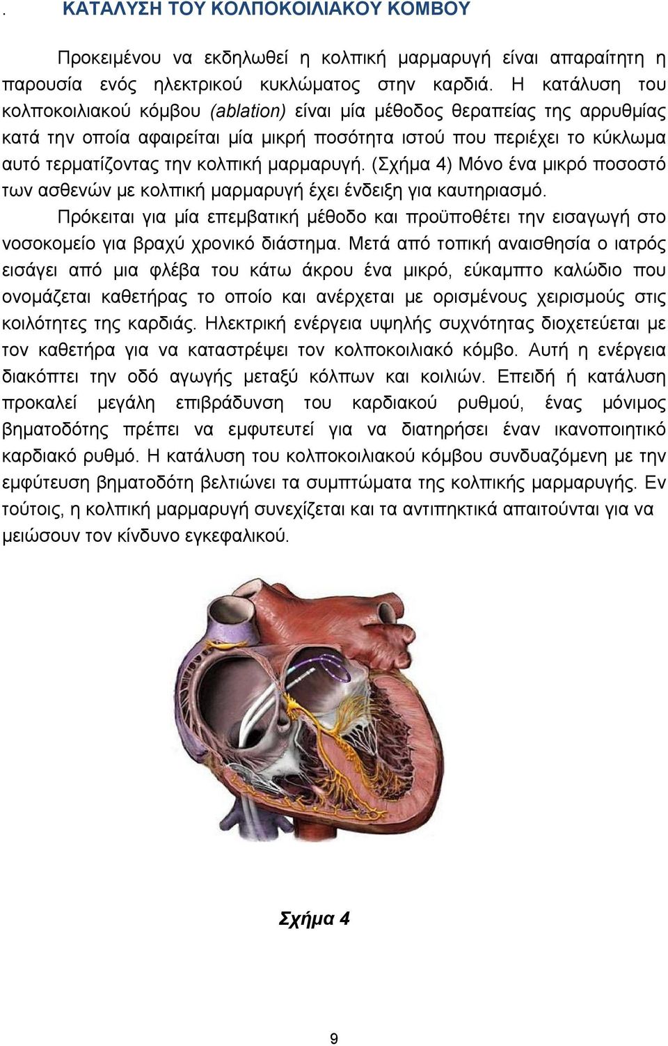 μαρμαρυγή. (Σχήμα 4) Μόνο ένα μικρό ποσοστό των ασθενών με κολπική μαρμαρυγή έχει ένδειξη για καυτηριασμό.