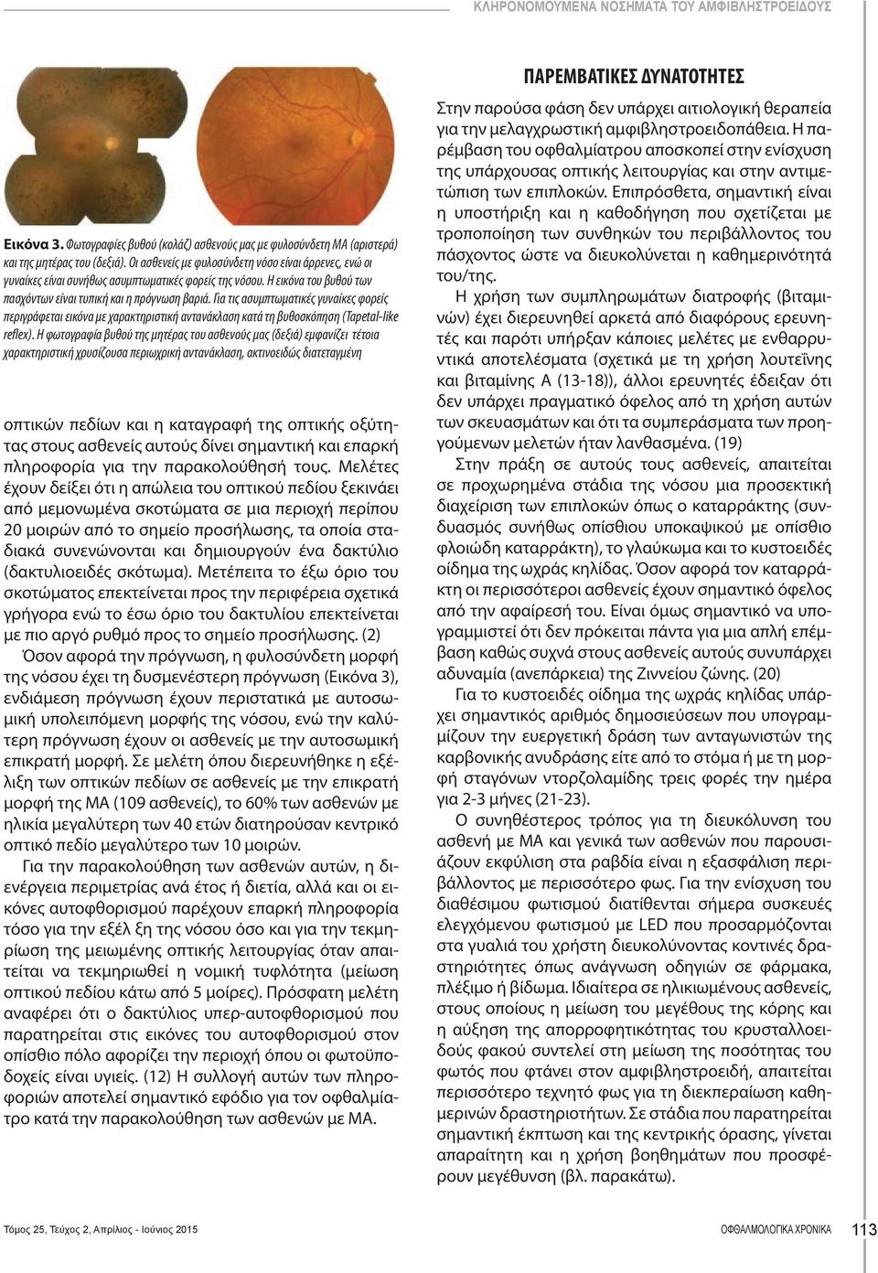 Για τις ασυμπτωματικές γυναίκες φορείς περιγράφεται εικόνα με χαρακτηριστική αντανάκλαση κατά τη βυθοσκόπηση (Tapetal-like reflex).
