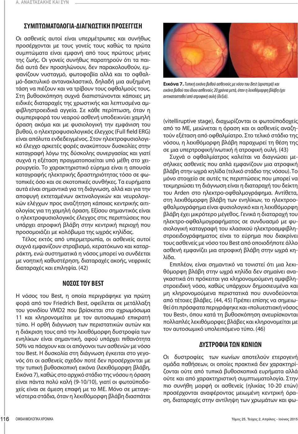 Οι γονείς συνήθως παρατηρούν ότι τα παιδιά αυτά δεν προσηλώνουν, δεν παρακολουθούν, εμφανίζουν νυσταγμό, φωτοφοβία αλλά και το οφθαλμό-δακτυλικό αντανακλαστικό, δηλαδή μια αυξημένη τάση να πιέζουν