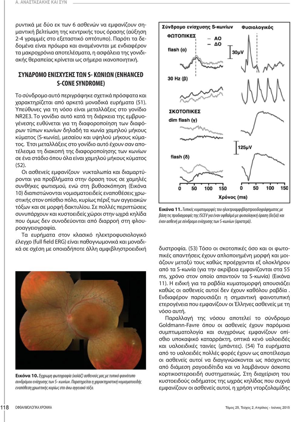 ΣΥΝΔΡΟΜΟ ΕΝΙΣΧΥΣΗΣ ΤΩΝ S- ΚΩΝΙΩΝ (ENHANCED S-CONE SYNDROME) Το σύνδρομο αυτό περιγράφηκε σχετικά πρόσφατα και χαρακτηρίζεται από αρκετά μοναδικά ευρήματα (51).