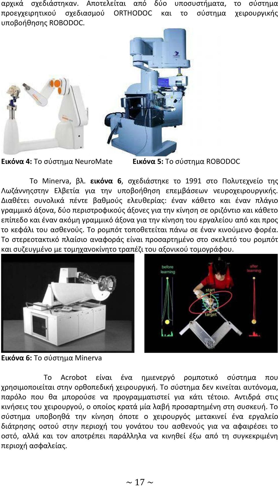 Διαθέτει συνολικά πέντε βαθμούς ελευθερίας: έναν κάθετο και έναν πλάγιο γραμμικό άξονα, δύο περιστροφικούς άξονες για την κίνηση σε οριζόντιο και κάθετο επίπεδο και έναν ακόμη γραμμικό άξονα για την