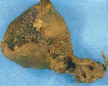 Spongia agaricina