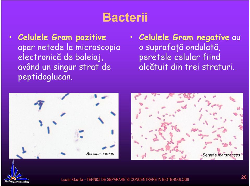 Celulele Gram negative au o suprafaţă ondulată, peretele celular