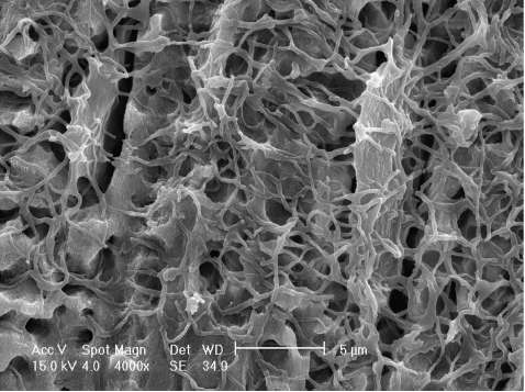 VDR & 1 α -hydroxylase expression in osteocytes Επάγει την έκφραση RANKL, FGF23, BMP7, osteocalcin,