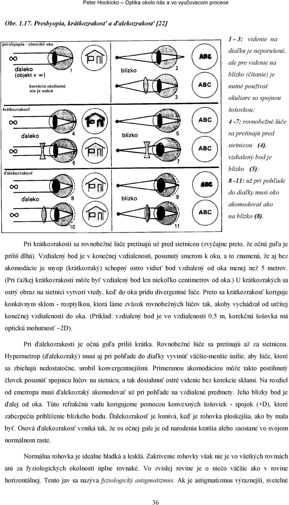 pretínajú pred sietnicou (4), vzdialený bod je blízko (5); 8-11: už pri pohľade do diaľky musí oko akomodovať ako na blízko (8).