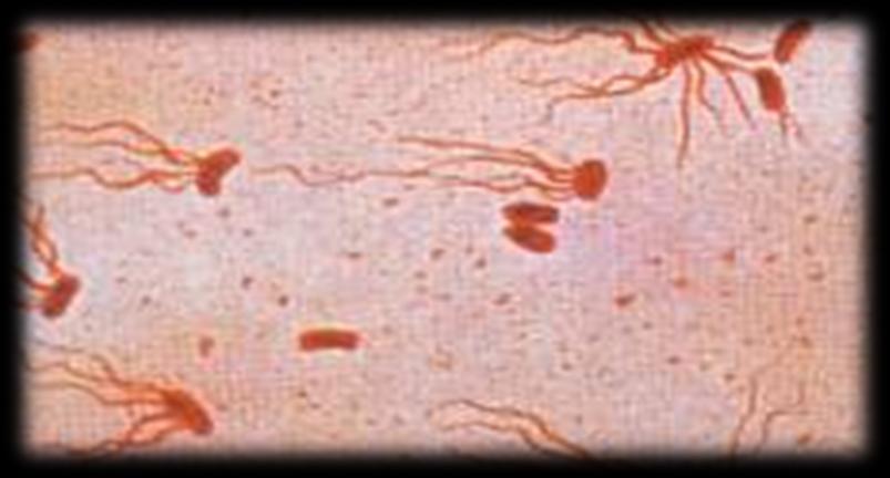Chryptosporidium parvum (Παθογόνα) Πρωτόζωα Βακτήρια Παθογόνα πρωτόζωα Ιστολυτική αμοιβάδα Πηγή: http://www.esemag.com/archive/0103/crypto.html Vibrio cholerae Παθογόνα βακτήρια Πηγή: http://image.