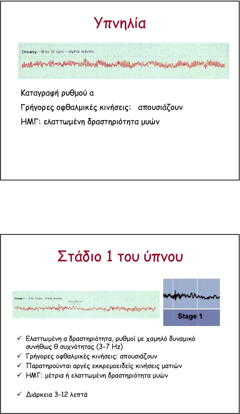 δυναµικό συνήθως θ συχνότητας (3-7 Hz) Γρήγορες οφθαλµικές κινήσεις: απουσιάζουν