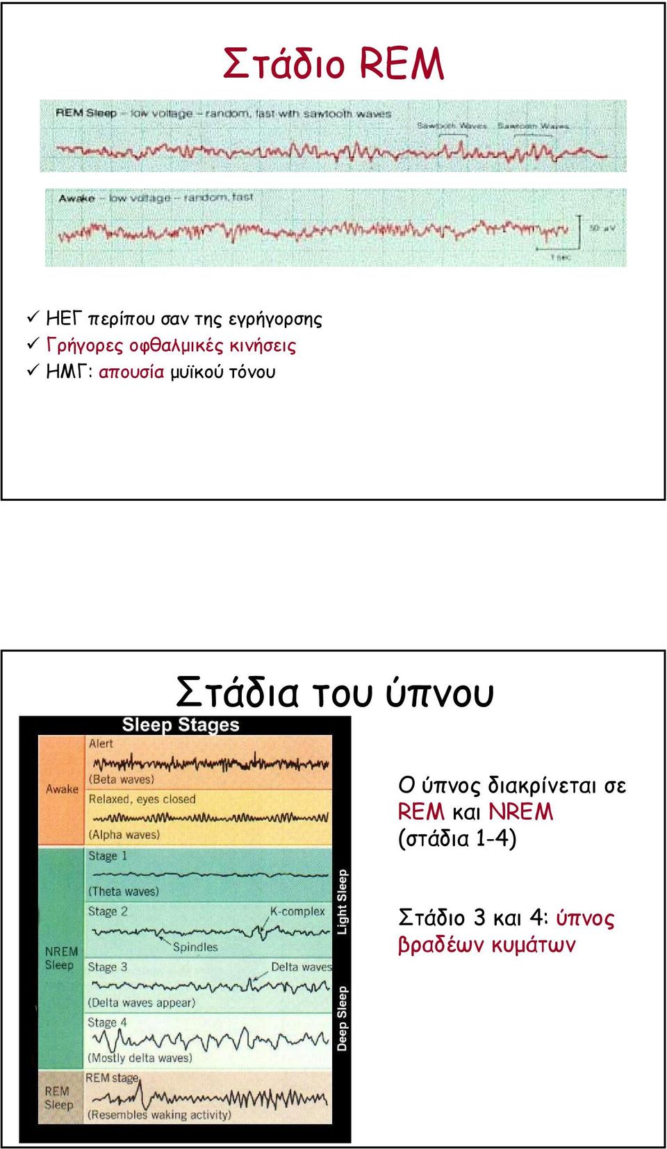 τόνου Στάδια του ύπνου Ο ύπνος διακρίνεται σε REM