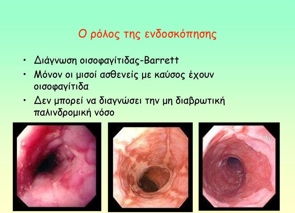 αζζεκείξ με θαύζμξ έπμοκ μηζμθαγίηηδα Δεκ