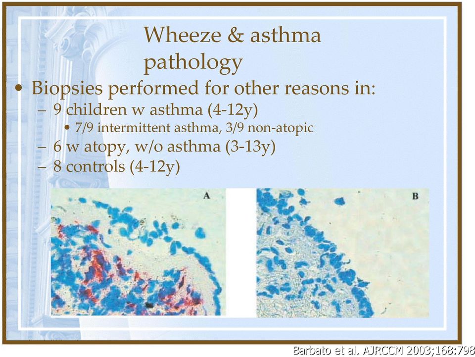 intermittent asthma, 3/9 non atopic 6 w atopy, w/o